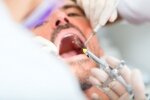 Здоровье: Аллергические реакции на стоматологические препараты и изделия